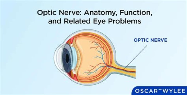 How do you keep your optic nerve healthy?