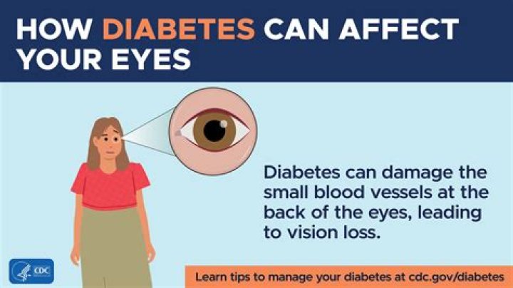 How do you lose your eyesight?