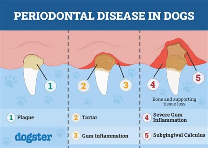 How do you shrink periodontal pockets?