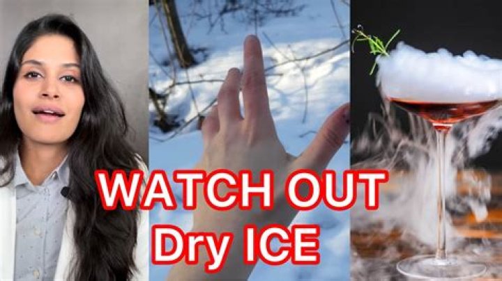 How do you treat a dry ice burn on your tongue?