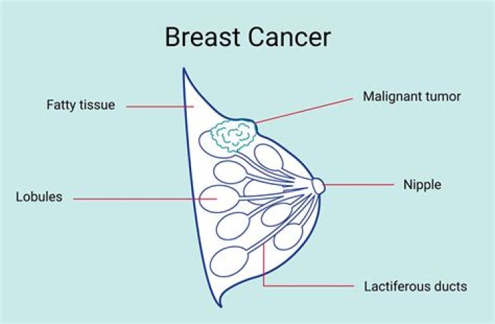 How does a tumor feel?