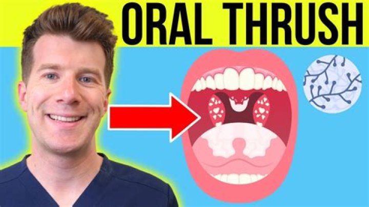 How does oral thrush make you feel?