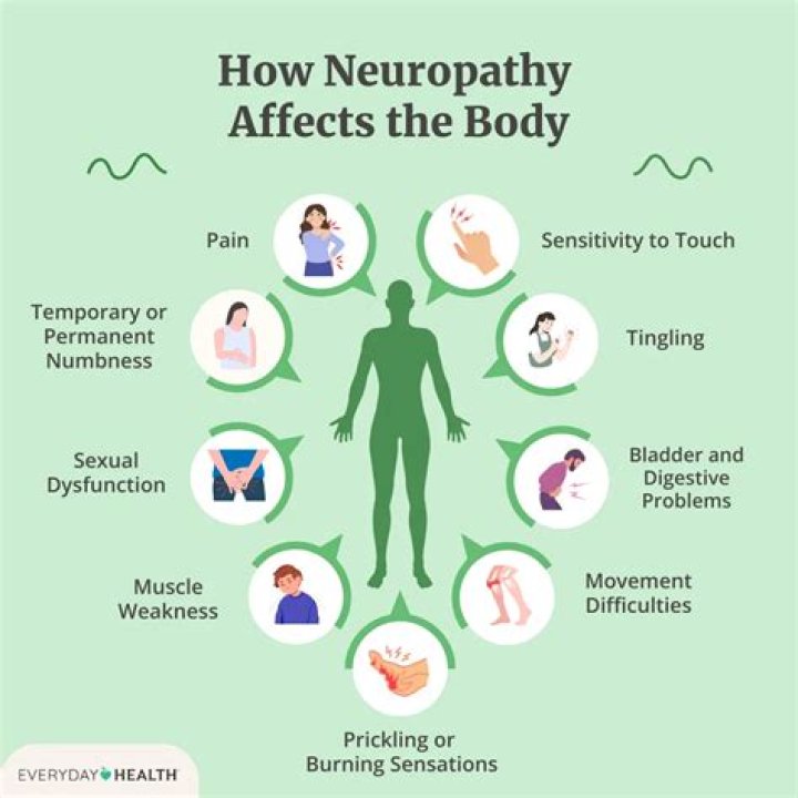 How fast does neuropathy progress?