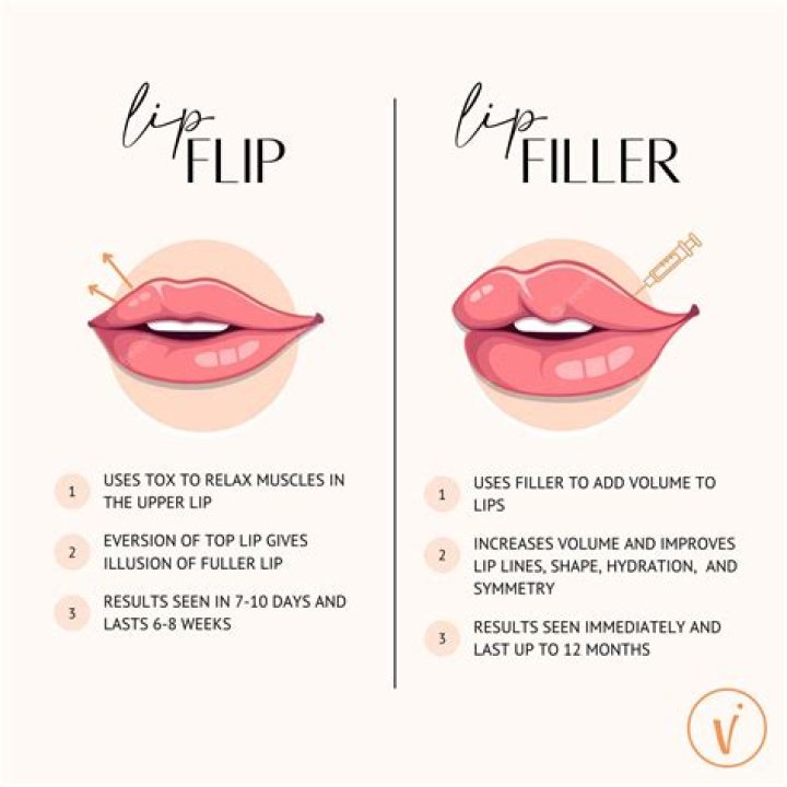 How long after a lip flip can you kiss?