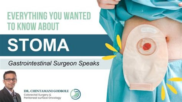 How long after a stoma surgery Can you swim?