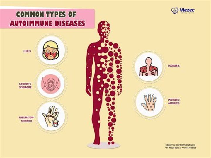 How long do autoimmune flare ups last?