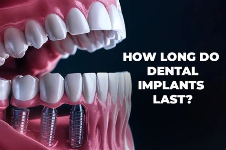 How long do ceramic hip implants last?