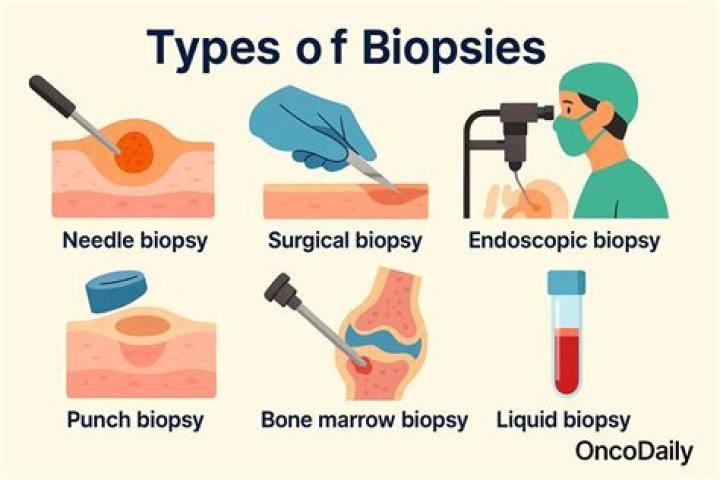 How long do lung biopsy results take?