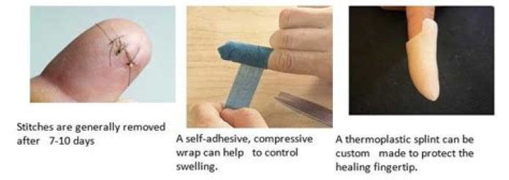 How long does it take for a glued cut to heal?