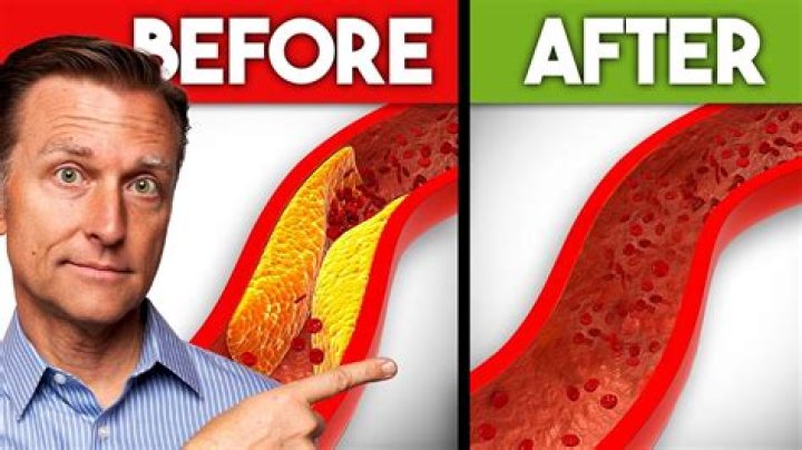How long does it take to clear arteries of cholesterol?
