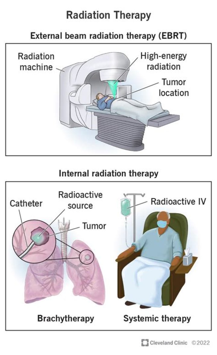 How long is a radiation session?