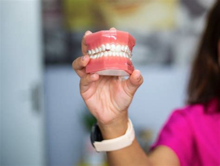How long should you wear dentures for the first time?