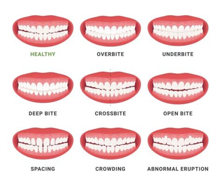 How long should your teeth be?