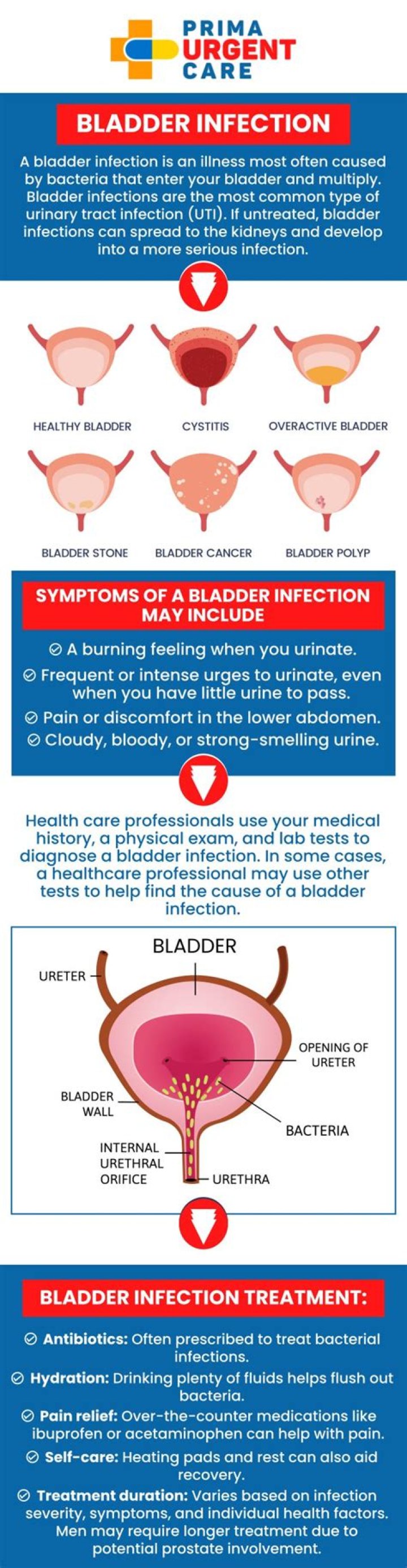 How long will a bladder infection last without antibiotics?