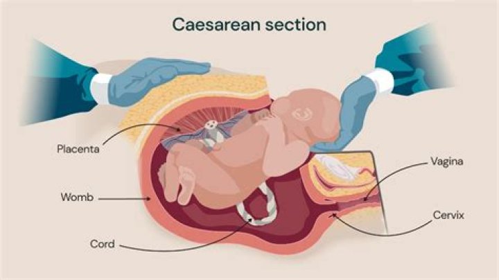 How long will they let you push before C section?