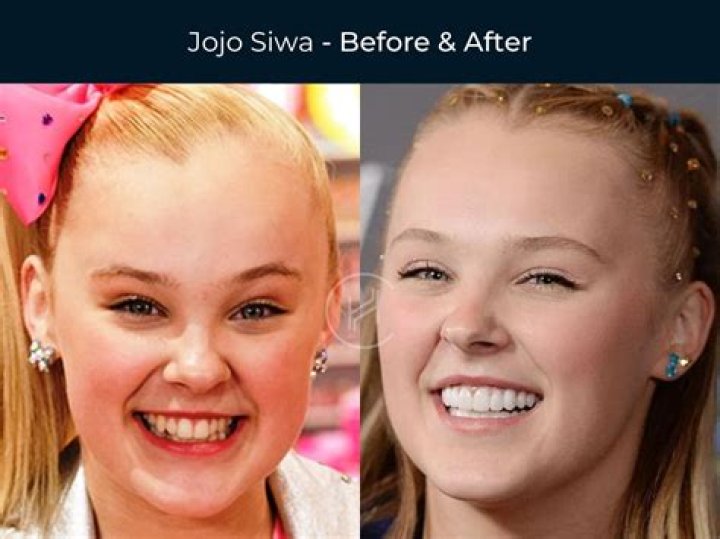 How many piercings does Jojo Siwa have?