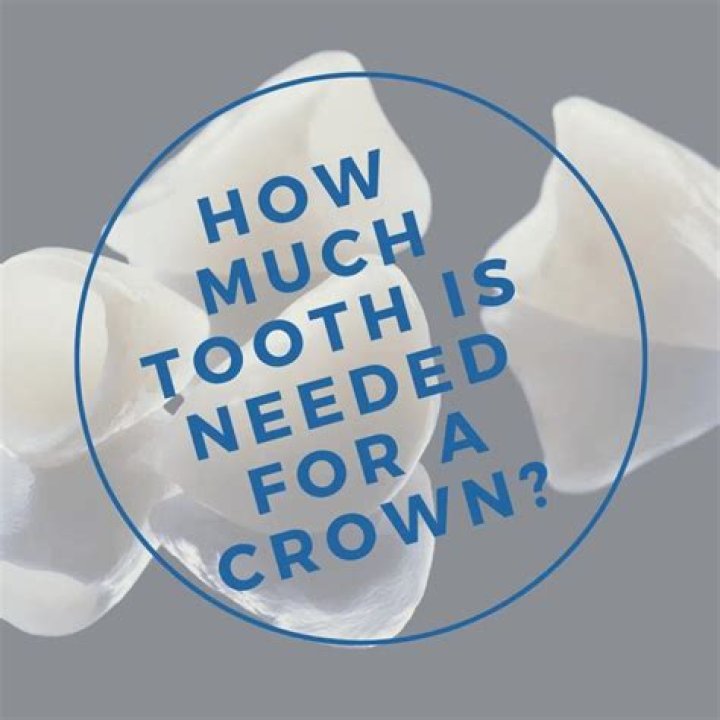 How much tooth is needed for a crown?