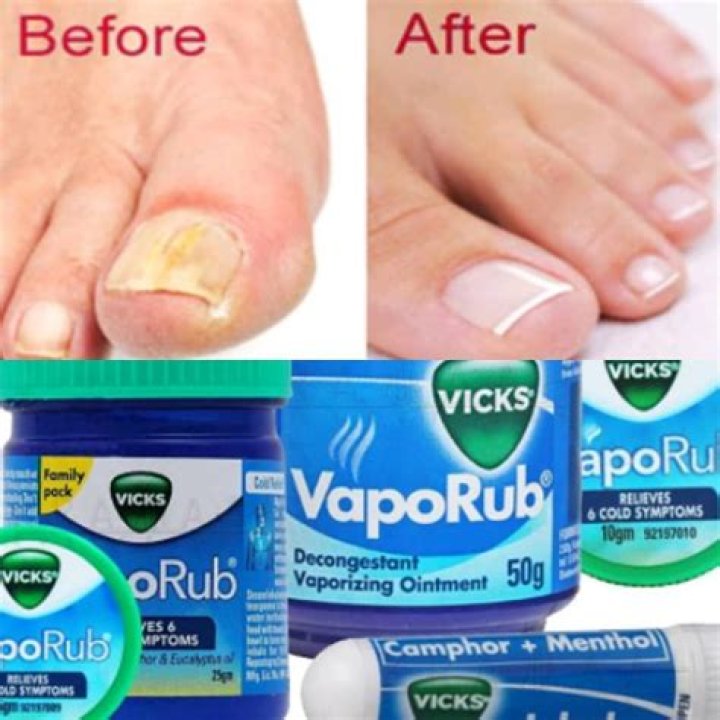 How often do you put Vicks on toenails?