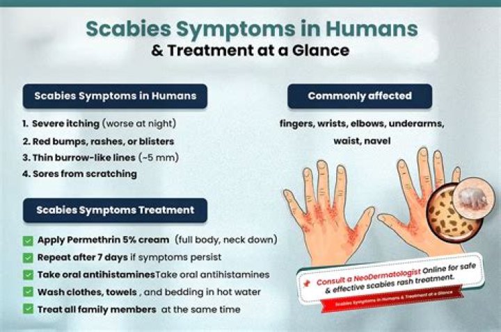 How serious is scabies?