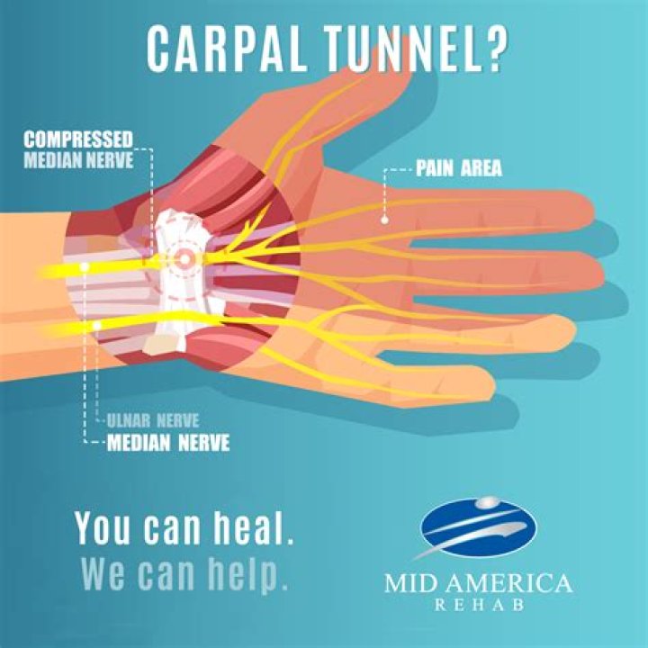 Is CBD oil good for carpal tunnel?
