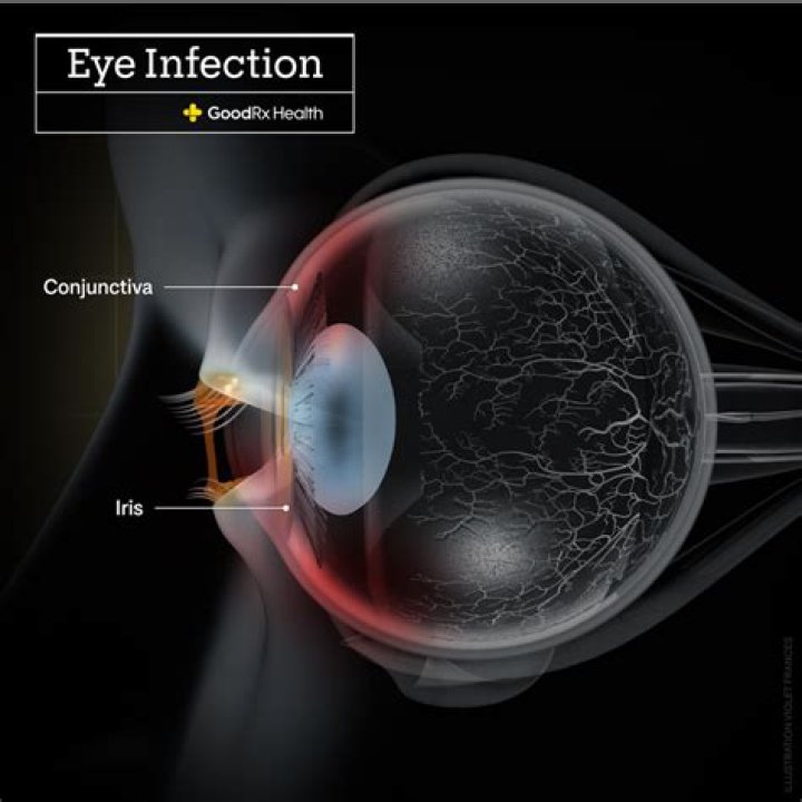 Is COVID eye symptom?