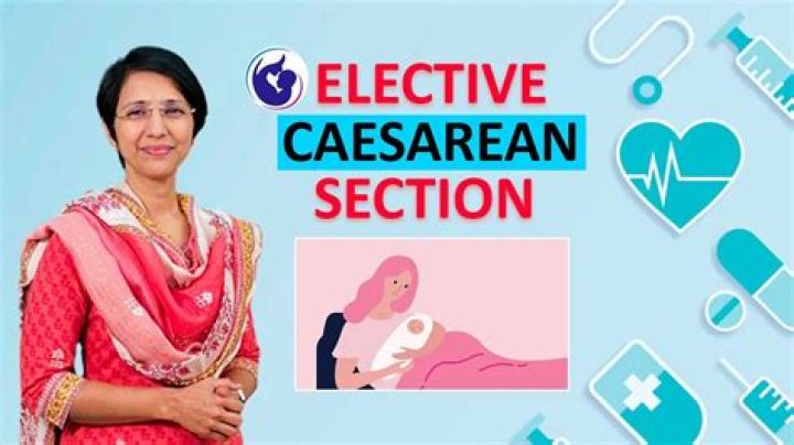 Is elective C-section better than emergency?