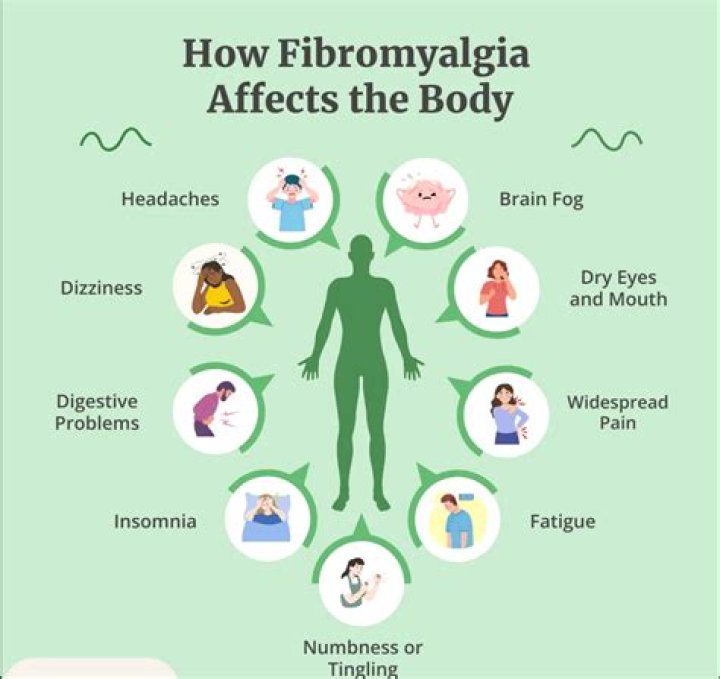 Is fibromyalgia a neurological condition?
