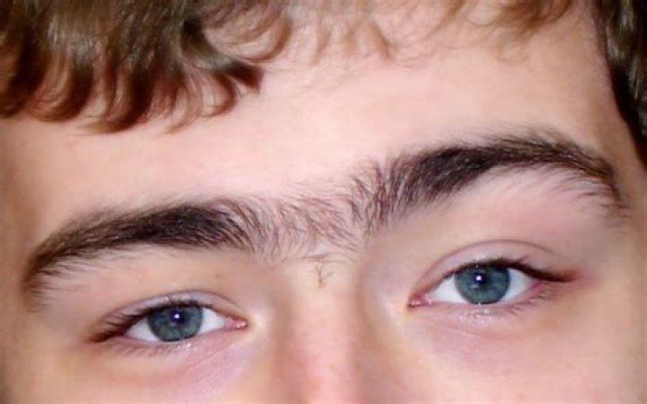 Is having a unibrow normal?