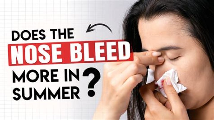 Is it normal to have multiple nosebleeds in one day?