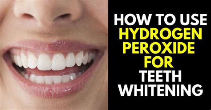 Is it OK to use hydrogen peroxide to whiten teeth?