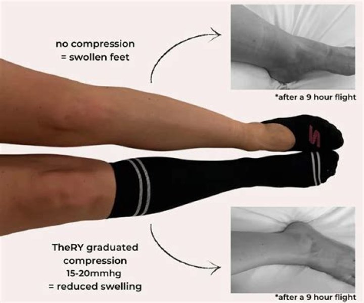 Is it OK to wear socks over a new tattoo?