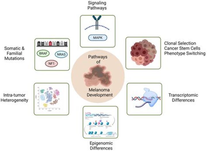 Is melanoma genetic?