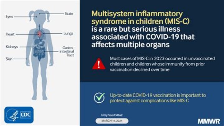 Is multisystem inflammatory syndrome in children (MIS-C) caused by COVID-19?