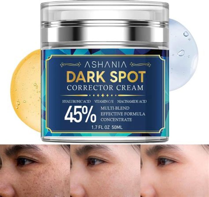 Is Nivea cream good for dark spots?