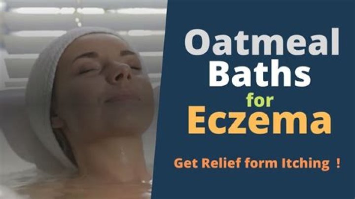 Is oatmeal good for eczema?