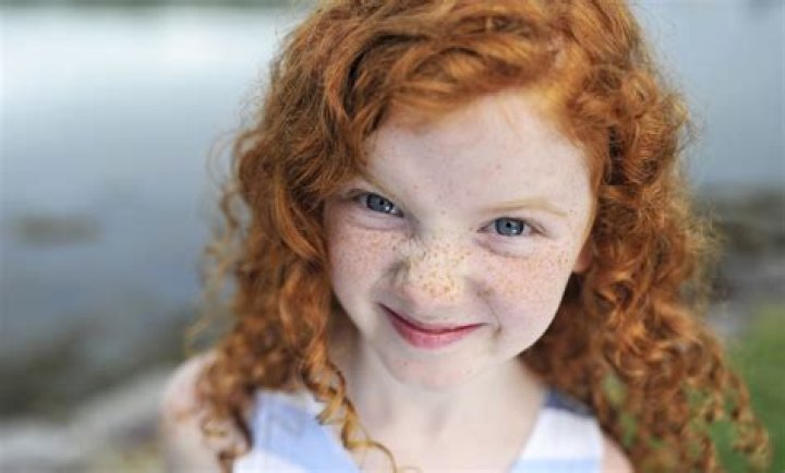 Is red hair rare?