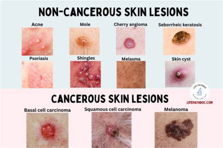 Is rice cancerous?