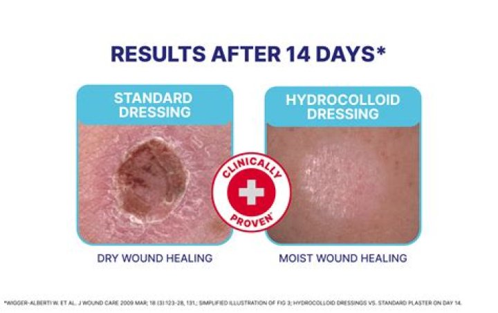 Is second skin waterproof?