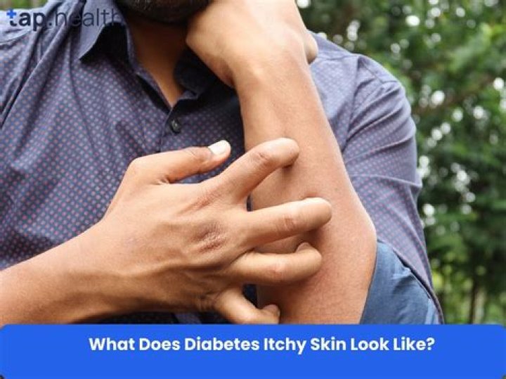 Is shrimp OK for Diabetes?