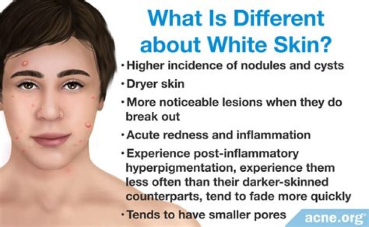 Is skin White Effective?