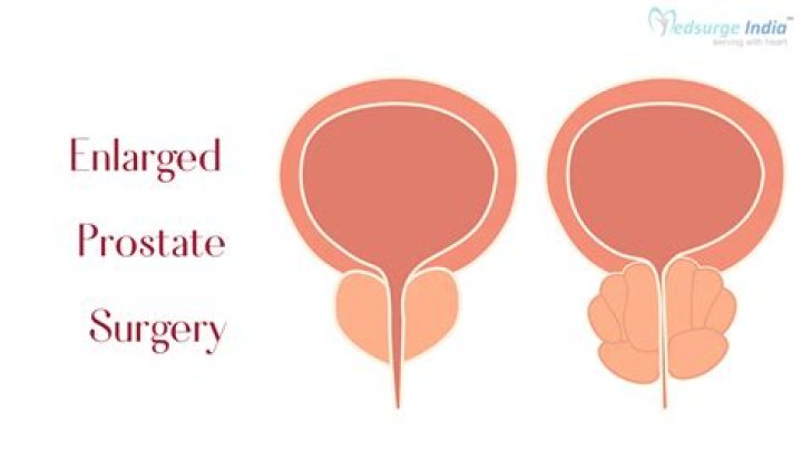 Is surgery necessary for enlarged prostate?