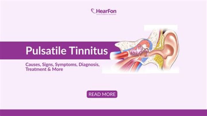 Is there a cure for pulsatile tinnitus?