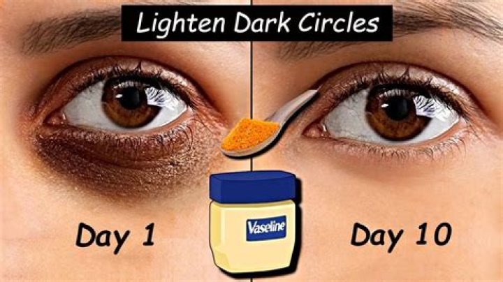 Is Vaseline good for dark circles?