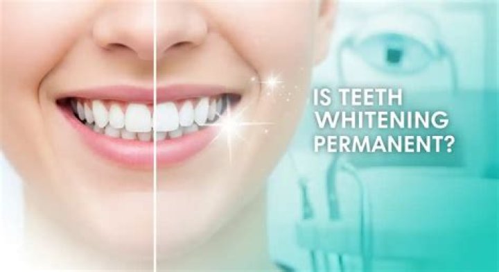 Is whitening permanent?