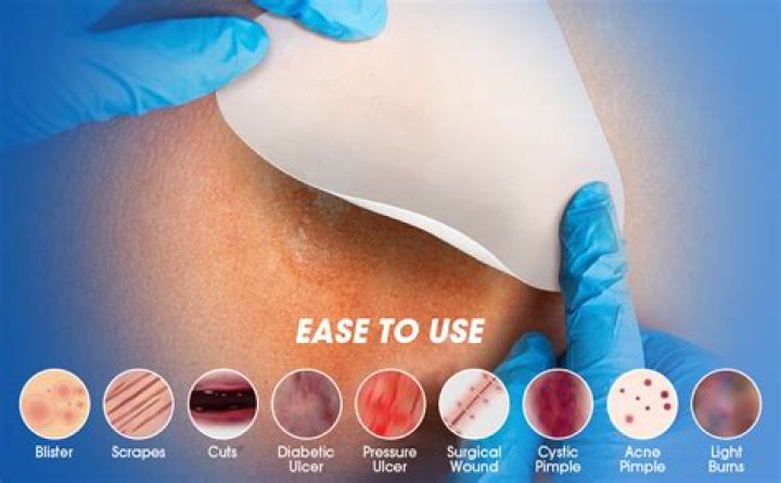 Should a glued wound bleed?