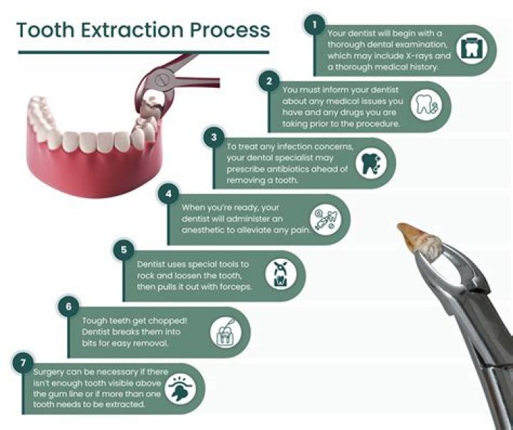 Should I take a day off work after tooth extraction?