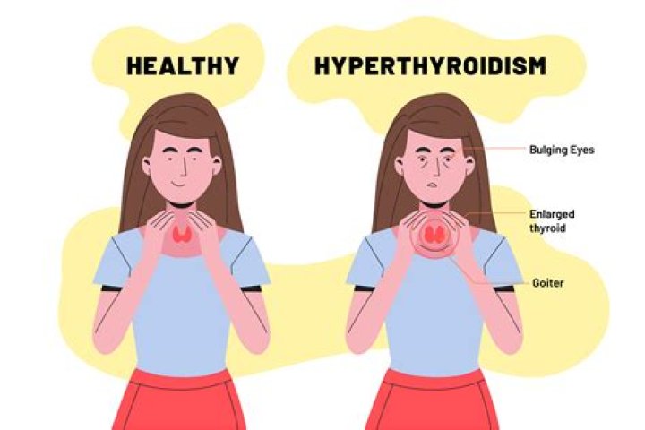 Should I worry about high TSH?