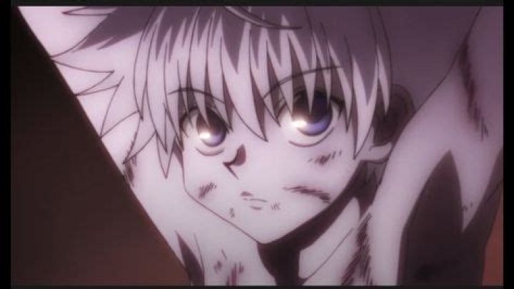 Was Killua abused?