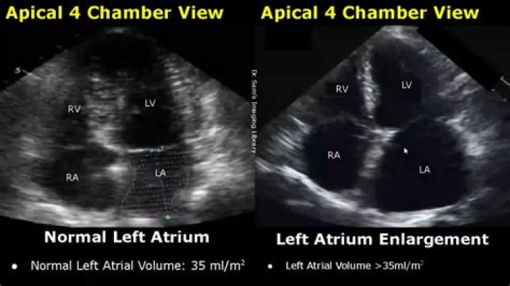 What 5 abnormalities can be found on the echocardiogram?