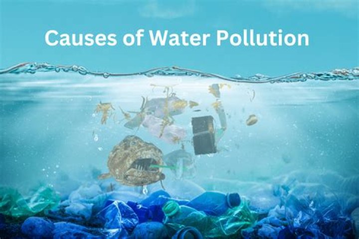 What are 3 causes of OCD?